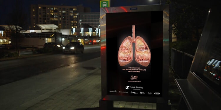 The Marie Keating Foundation – The First Poster To Catch Lung Cancer