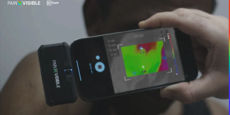 Aritium — PainVisible By VML, spain