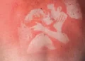 Sunburns Tattoos By Thomas Mailaender