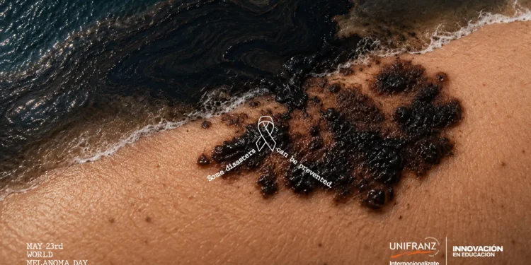 World Melanoma Day – Some disasters can be prevented By Malditos Agency